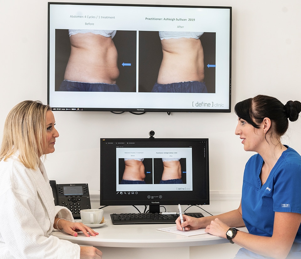 Coolsculpting consultation with Define Clinic in London and Beaconsfield.