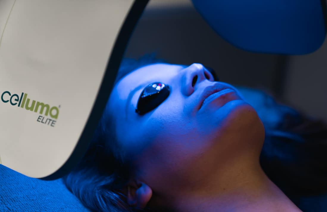 Celluma LED light therapy at Define Clinic London & Beaconsfield