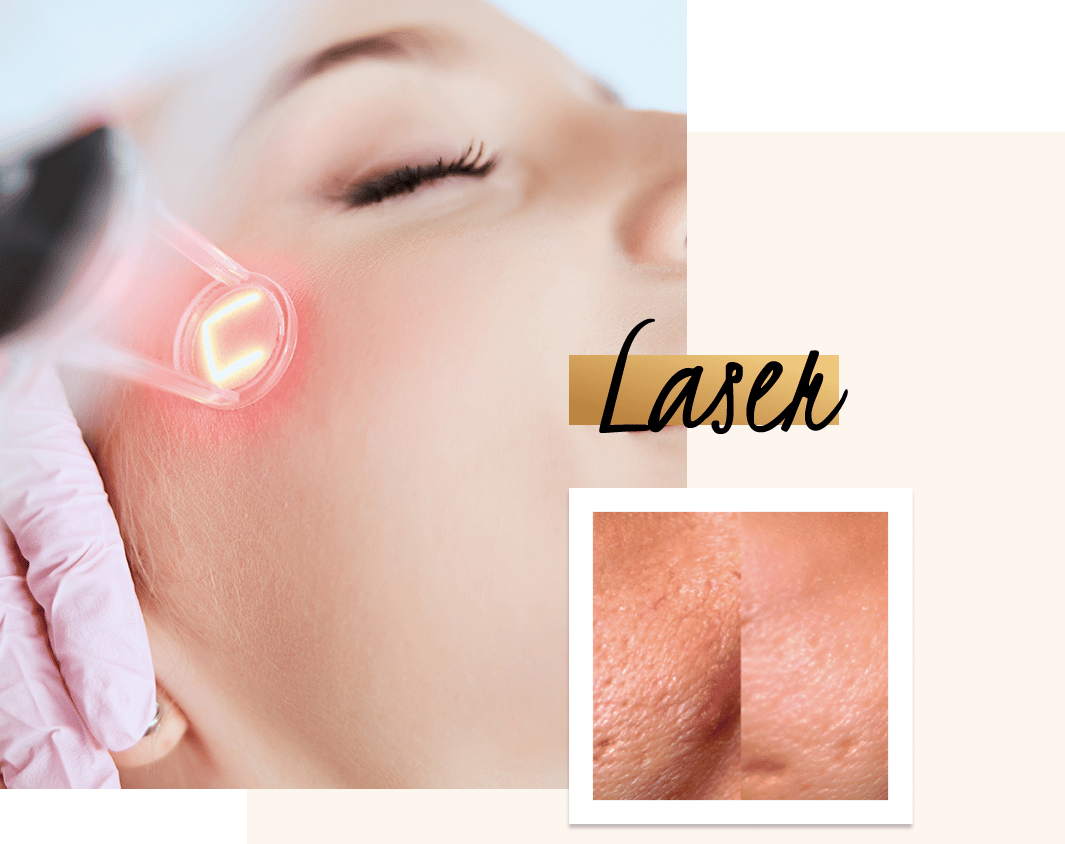 Laser Skin Tightening Experts - Perfect Body Laser & Aesthetics