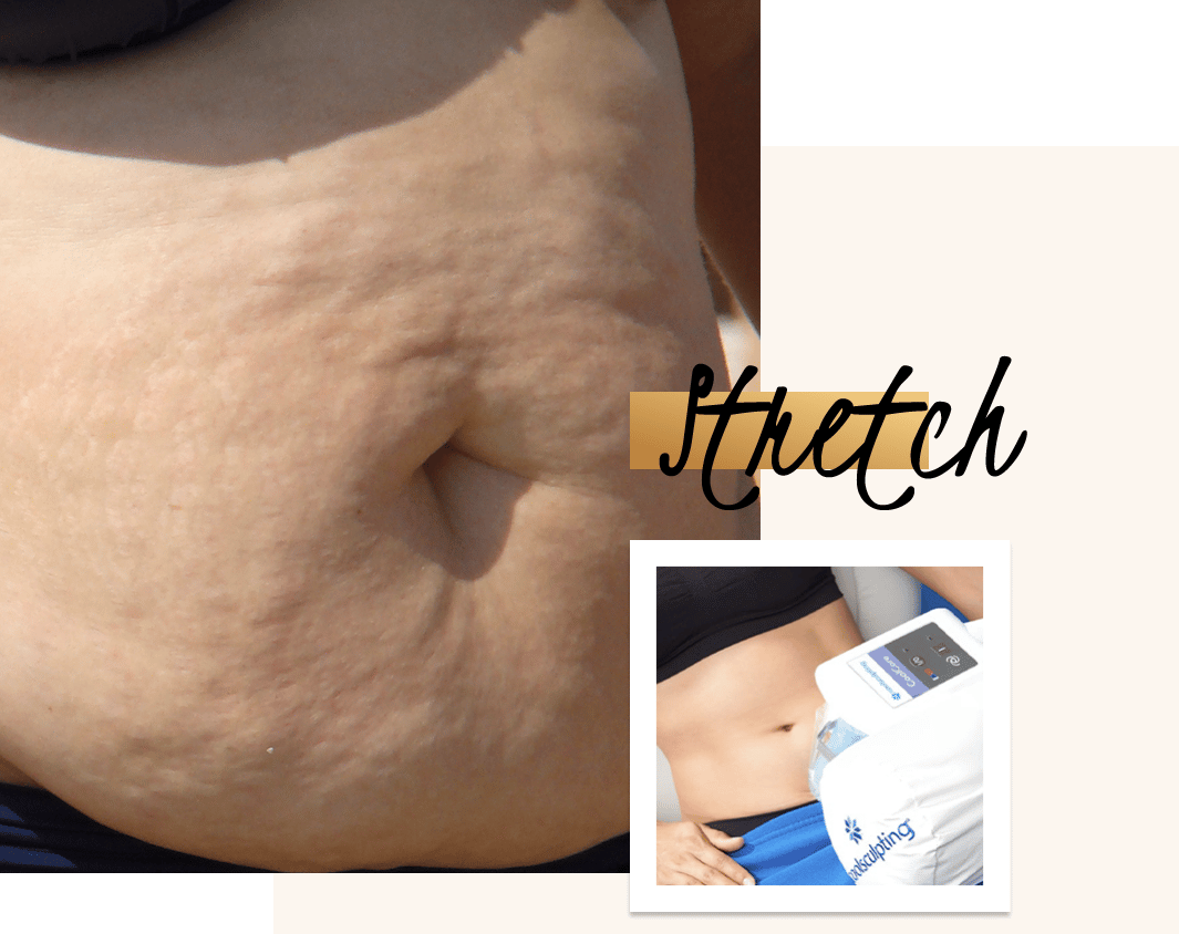 Toning belly online skin