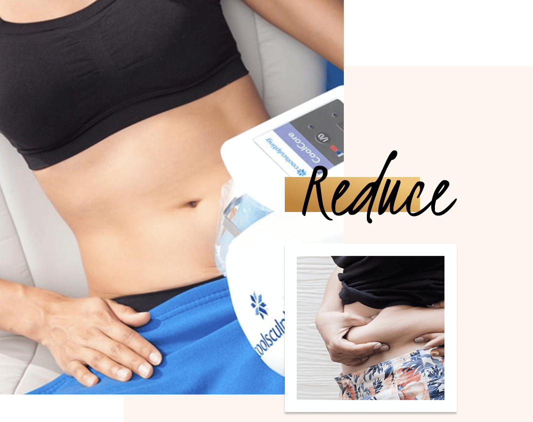 CoolSculpting Stomach  Reduce Belly Fat Without Surgery