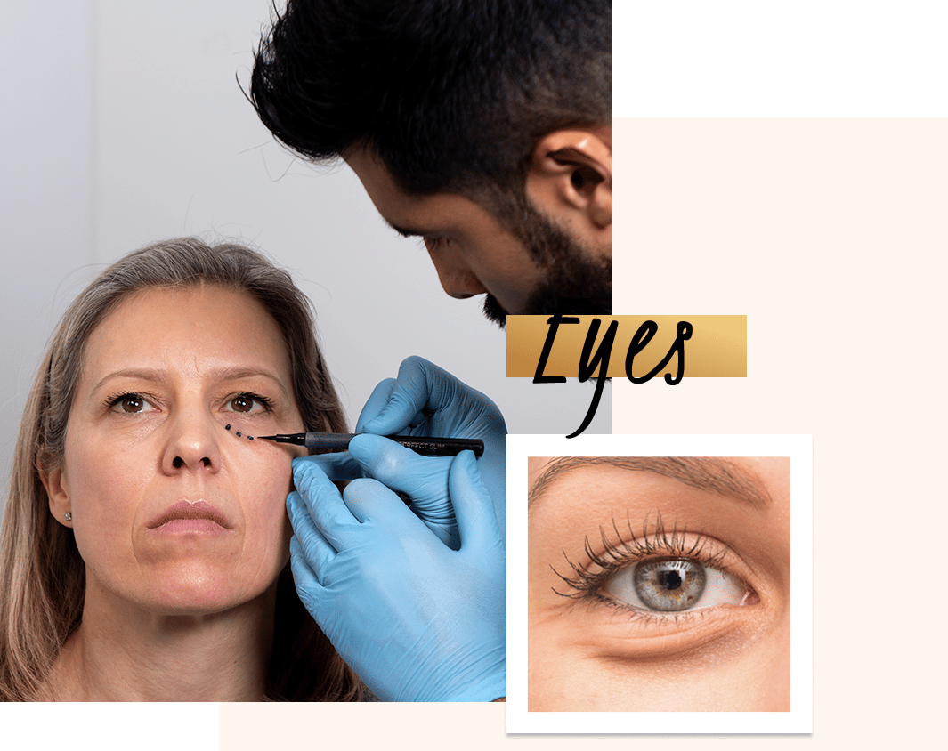 Do you suffer from bags under your eyes? At Define Clinic in London & Beaconsfiled we have natural looking correction for eye bags that helps restore volume and create a more youthful, beautiful appearance.