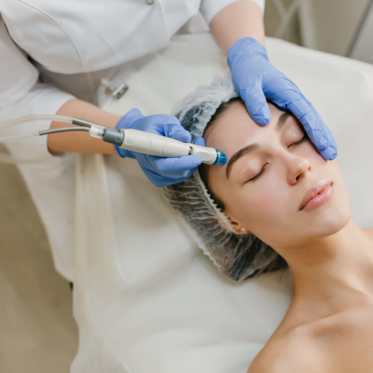 Laser Resurfacing vs Microneedling: Which Treatment Is Right For You?