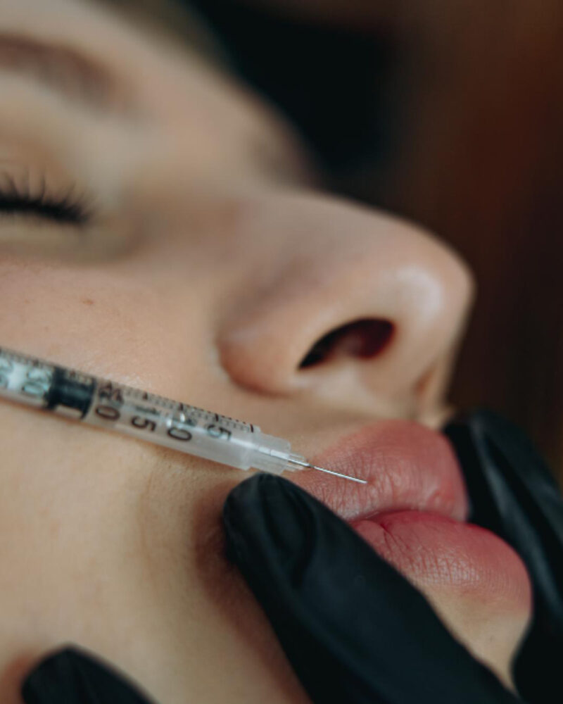 How Injectables London Work Alongside Skin Treatments