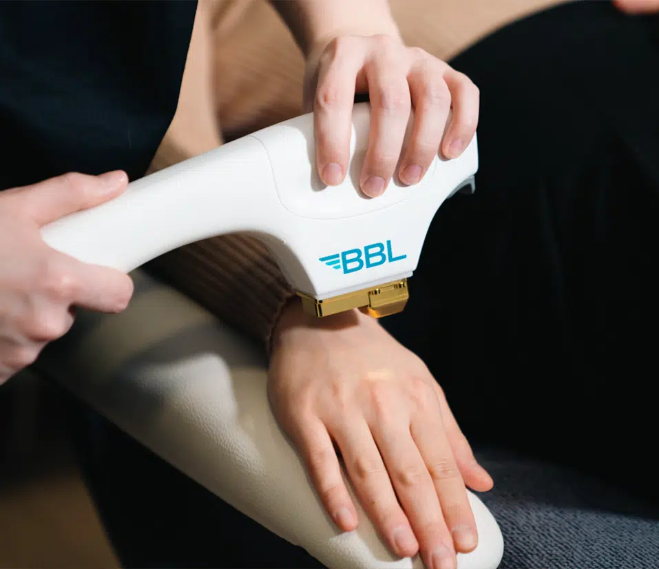 BBL Sciton machine treating hands