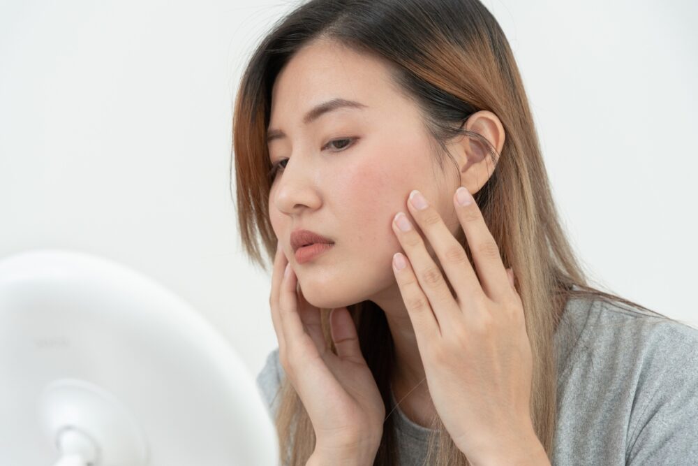 Facial Redness & Rosacea