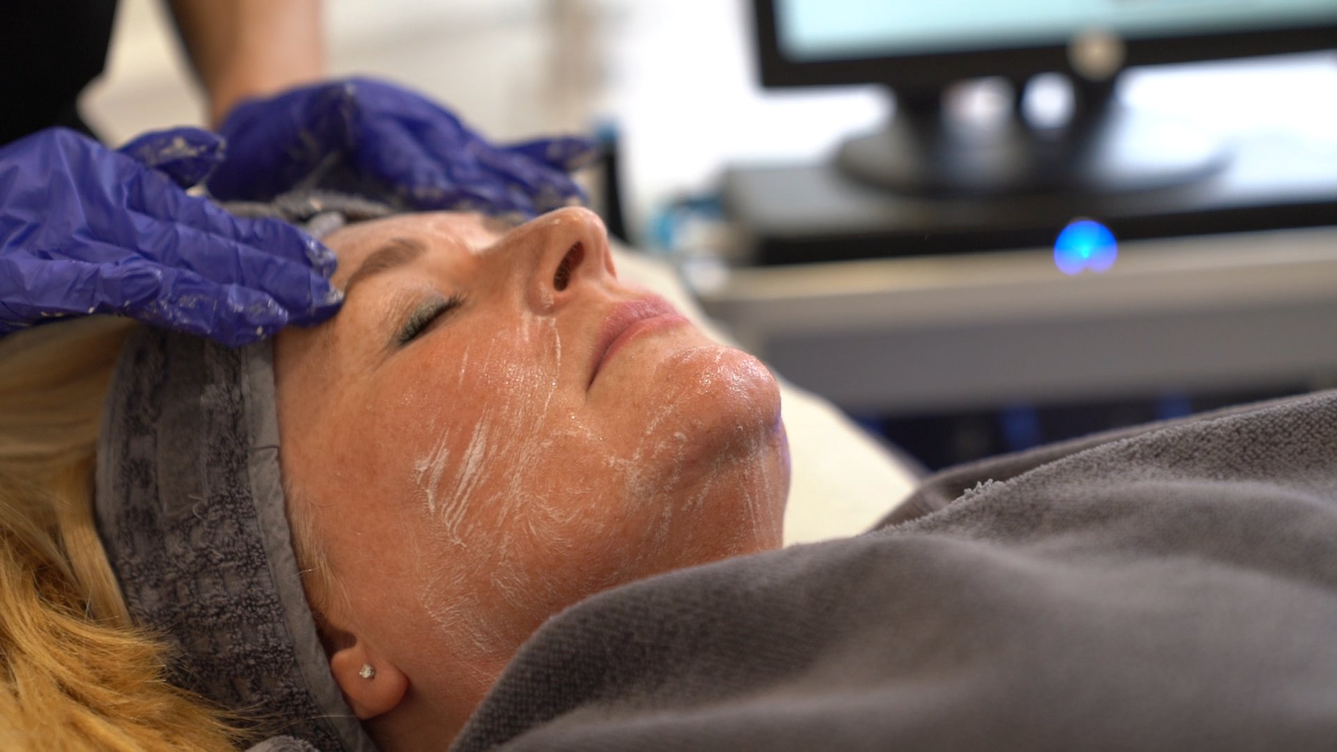 Hydrafacial treatment