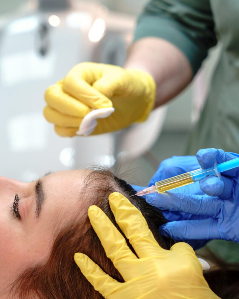 PRP in London explained: Is this treatment really worth the hype