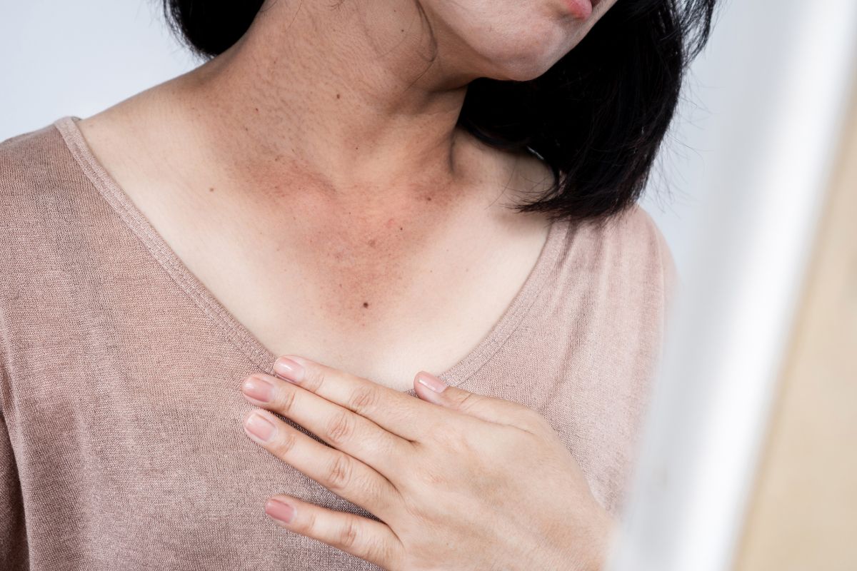 Pigmentated tan line from sun exposure