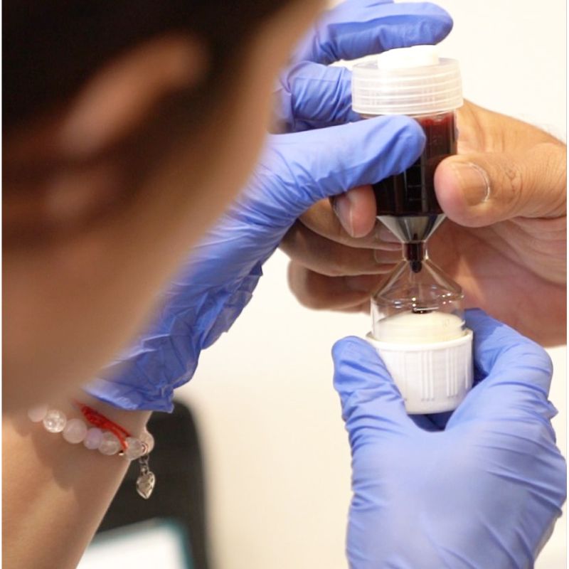 Blood testing PRP