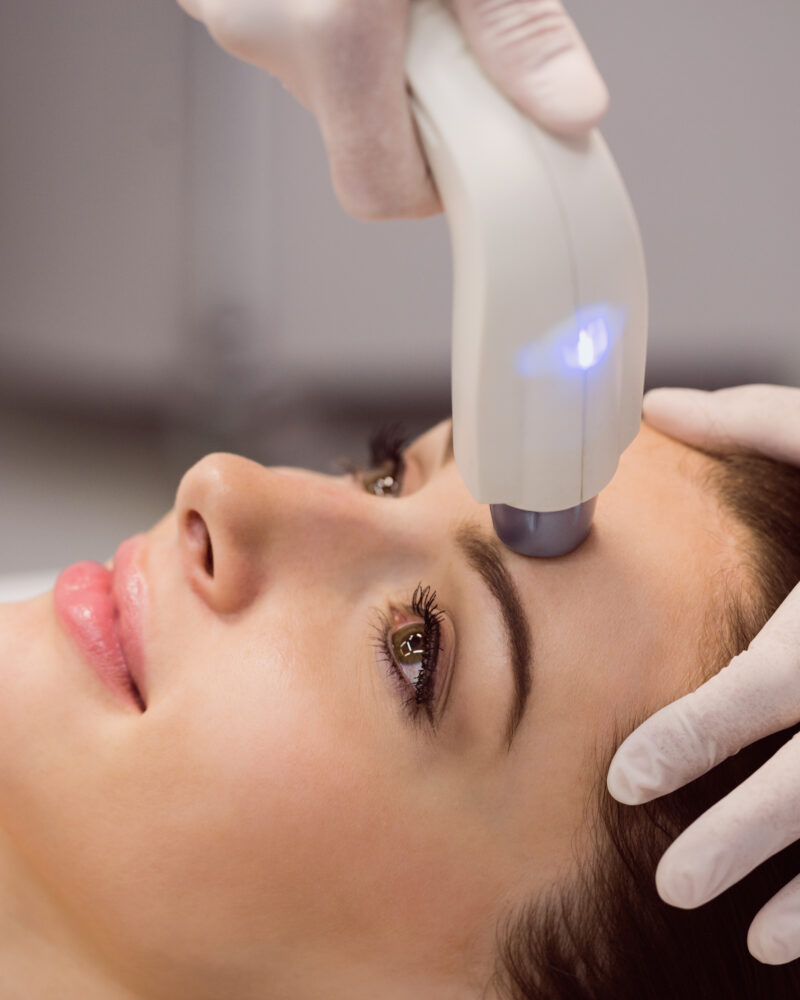 What You Need To Know About Erbium Laser Treatments