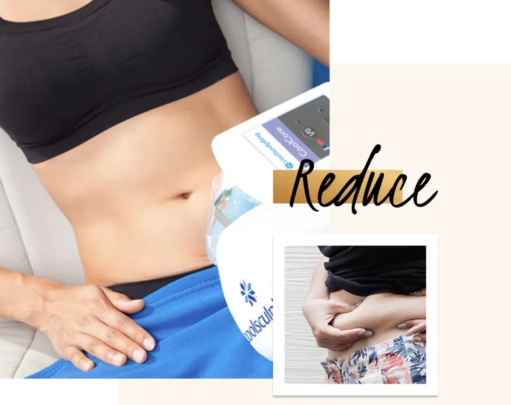 Tummy Fat and Stomach Fat