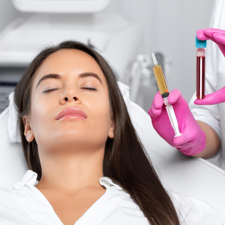 PRP in London is gaining hype — but does it work?